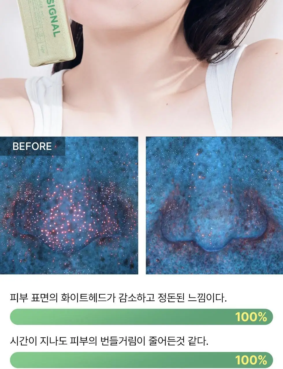 [머랭솝/팩브러쉬증정] 스킨시그널 클레이 효소클렌저 70g 팩브러쉬 증정기획 (핑크/그린) 상세페이지 69